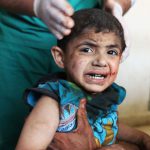 A Syrian child receives treatment at a makeshift hospital following an air strike on a vegetable market in Maaret al-Numan, in Syria's northern province of Idlib, on April 19, 2016.