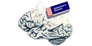 World Alzheimer's Day - 21st September