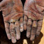 The hands of a mine worker are covered with fine dust. According to an affidavit filed in the Supreme Court this year by the Centre, over 1.4 lakh people work in Rajasthan’s mines and all could be afflicted by the lung disease. Despite being one of the oldest known occupational hazards, cases of silicosis are often miscounted as tuberculosis as silicosis primarily renders the respiratory system vulnerable to other terminal diseases.