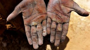 The hands of a mine worker are covered with fine dust. According to an affidavit filed in the Supreme Court this year by the Centre, over 1.4 lakh people work in Rajasthan’s mines and all could be afflicted by the lung disease. Despite being one of the oldest known occupational hazards, cases of silicosis are often miscounted as tuberculosis as silicosis primarily renders the respiratory system vulnerable to other terminal diseases.