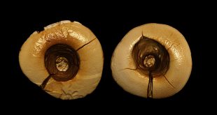 World's oldest dental fillings
