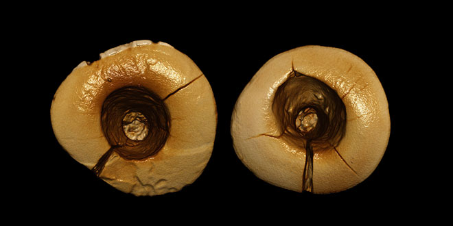 World's oldest dental fillings