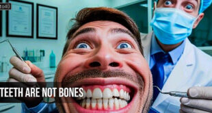 दांतों की गिनती हड्डियों में क्‍यों नहीं होती?