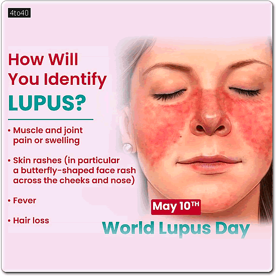 On this World Lupus Day (May 10th), let’s spread awareness about this often misunderstood autoimmune disease. Early diagnosis can make a big difference!