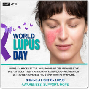 World Lupus Day is observed annually on May 10 to raise global awareness of lupus