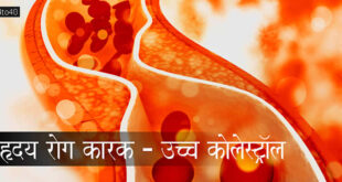 हृदय रोग कारक - उच्च कोलेस्ट्रॉल: Heart Disease Prime Factor - High Cholesterol