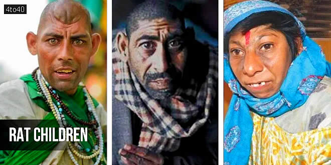 रैट चाइल्ड के रूप में कहे जाने वाले इन बच्चों में असामान्य रूप से छोटा सिर, गोल जबड़े और विकृत माथा होता है। पाकिस्तान के इस्लामिक गणराज्य के गुजरात शहर में ये बच्चे शाहदौला की दरगाह में शरण पाते हैं